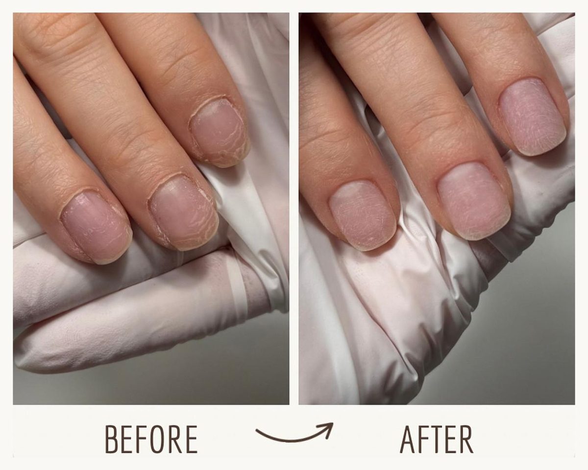 Before and after cuticle work: overgrown cuticles on the left, a clean cuticle line on the right